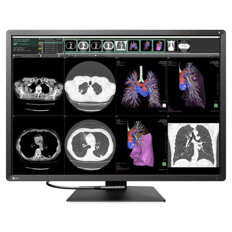 Медицински монитор EIZO RadiForce RX1270 12MP Цветен, EIZO-RX1270