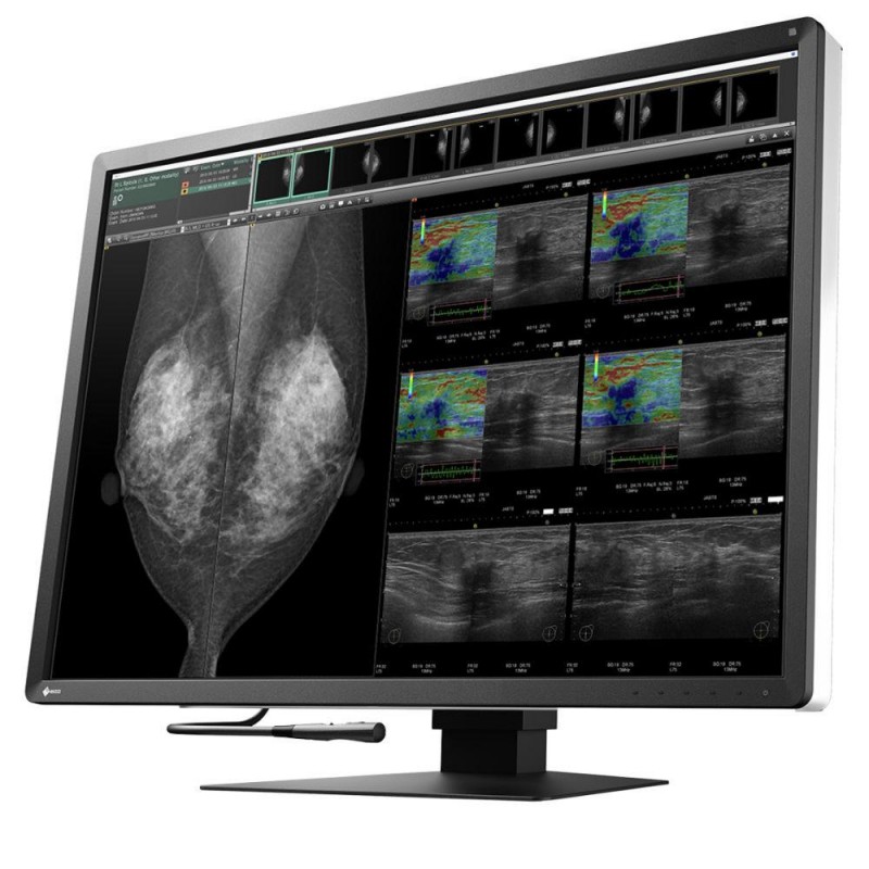 Медицински монитор EIZO RadiForce RX1270 12MP Цветен, EIZO-RX1270